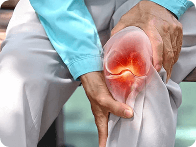 Osteoarthritis blog feature image